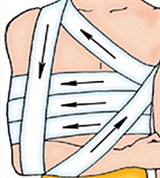 Повязка «Дезо»