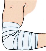 Повязка на Локоть