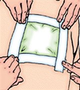 Повязка на бедро