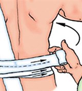 Повязка на грудную клетку