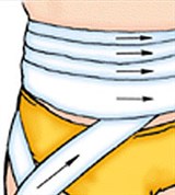 Повязка на нижнюю часть живота и верхнюю часть бедра