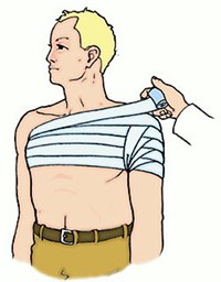 Повязка на плечевой сустав