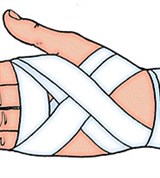 Повязка на тыльную часть кисти