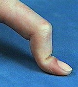 Правильное и Неправильное положение пальцев