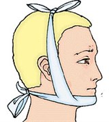 Пращевидная повязка на Подбородок