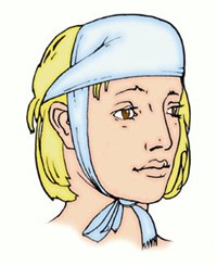 Пращевидная повязка на лоб