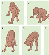 Прогрессирующая мышечная дистрофия. вставание с пола «лесенкой»