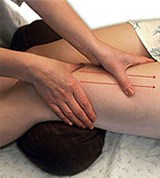 Продольное Попеременное поглаживание на передней поверхности бедра