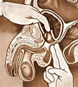 Простатэктомия