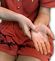 РАЗМИНАНИЕ ПОДУШЕЧКОЙ БОЛЬШОГО ПАЛЬЦА НА ЛАДОНИ