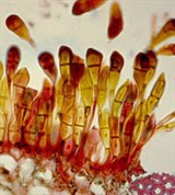 Ржавчинные грибы (Хлебная ржавчина)