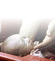 Роды в воду