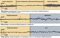 Сон (физиологические ритмы: Alfa-, Beta-, Theta-волны)