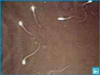 Сперматозоиды (видео)