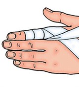 Спиральная повязка на палец