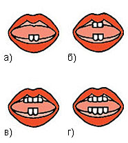 Схема прорезывания молочных зубов у грудного ребенка