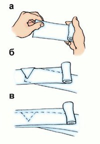ТЕХНика НАЛОЖЕНИЯ ПОВЯЗКИ
