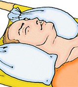 Транспортировка пострадавшего при переломах шейного отдела позвоночника (2)