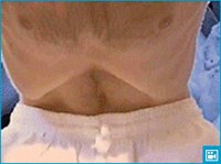 Уддияна бандха Крийя