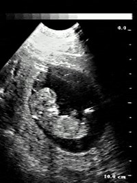 Ультразвуковое сканирование