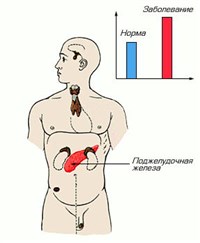 Уровень гормона при гипогликемии