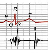 Фонокардиография