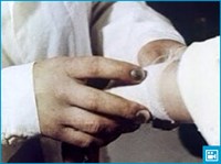 Химические ожоги кожи и слизистых оболочек (видео)