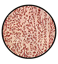 Холерные Вибрионы