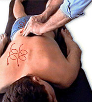 ЩИПЦЕВИДНОЕ РАЗМИНАНИЕ НА ДЛИННЫХ МЫШЦАХ СПИНЫ