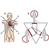 Электрокардиография (классические биполярные отведения) (1)