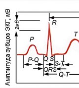 Электрокардиография (униполярные отведения) (2)