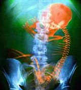 Эмбриология