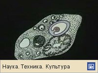 ЯЙЦЕКЛЕТКА (выход в брюшную полость, видео)