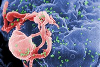 ВИЧ (вирус под микроскопом)