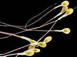 Мужские половые клетки (сперматозоиды)