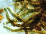 Синезеленые водоросли (Сцитонема)