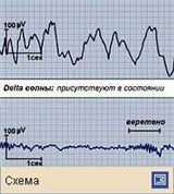 Сон (физиологические ритмы: Delta-волны, веретена и К-комплексы)